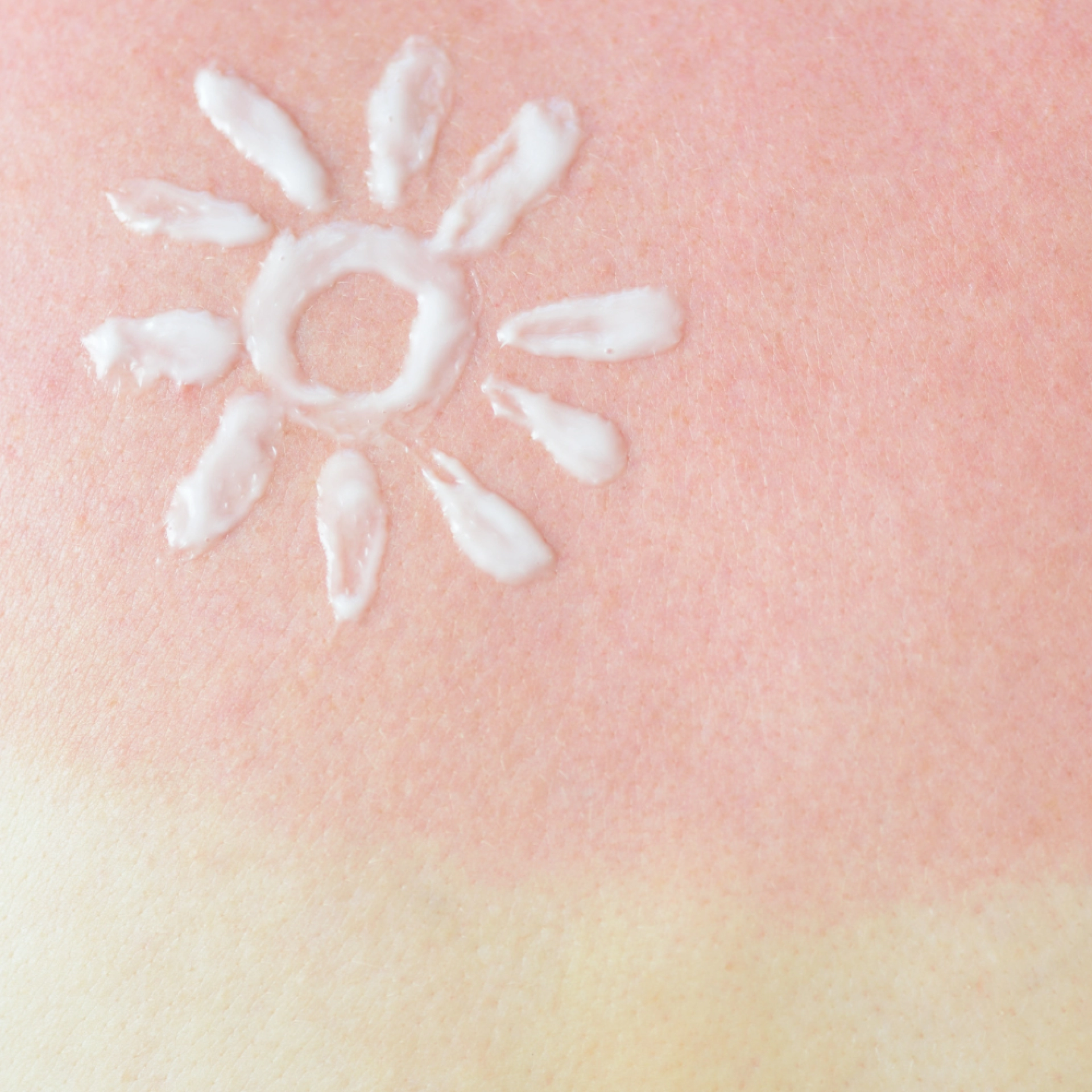 After Sun Lotion | Gel Reparador Efecto Calmante y Refrescante 200 ml - Sun Defense - Bruno Vassari ®