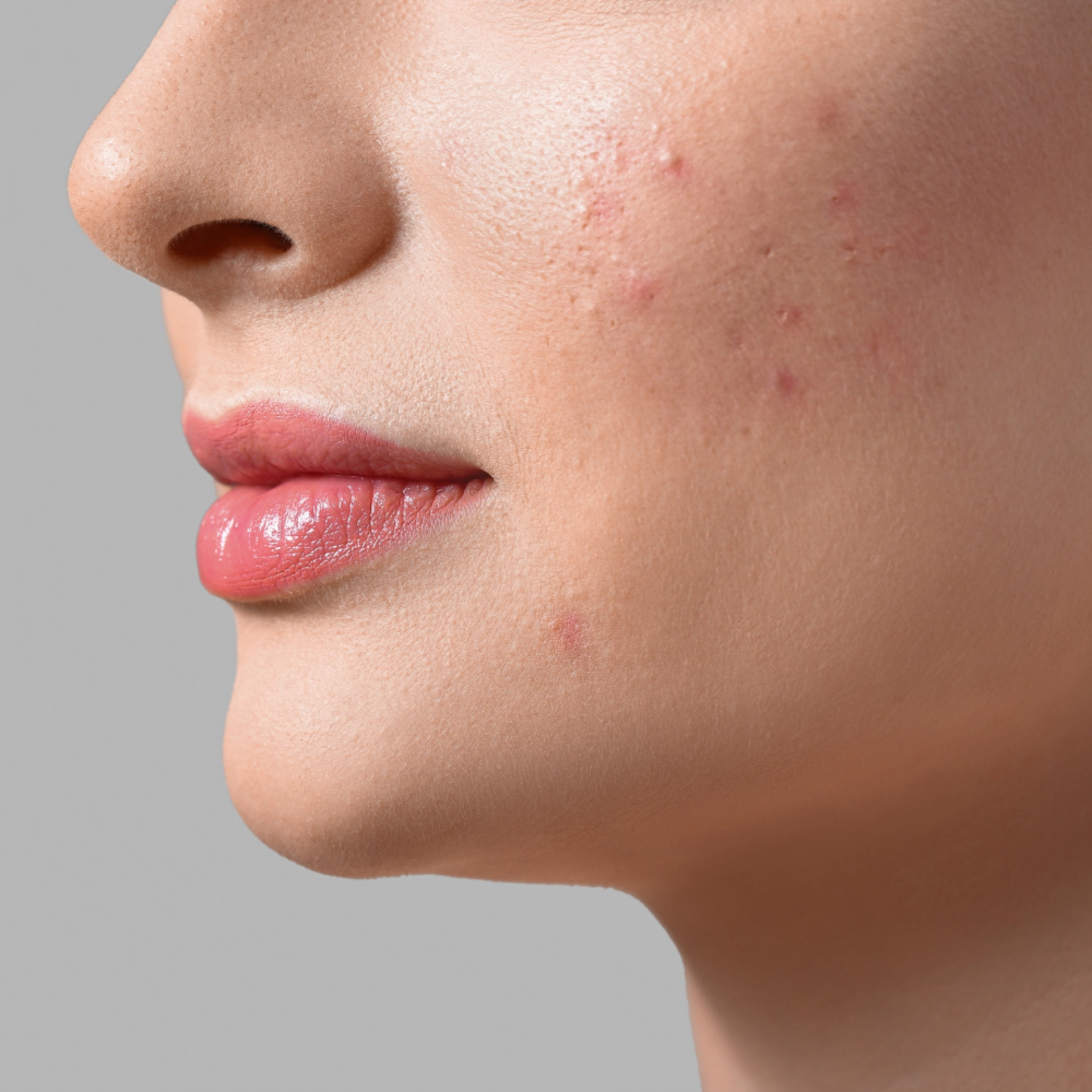 Cleansing Gel | Gel limpiador 150ml - Pure Solutions - Bruno Vassari ®