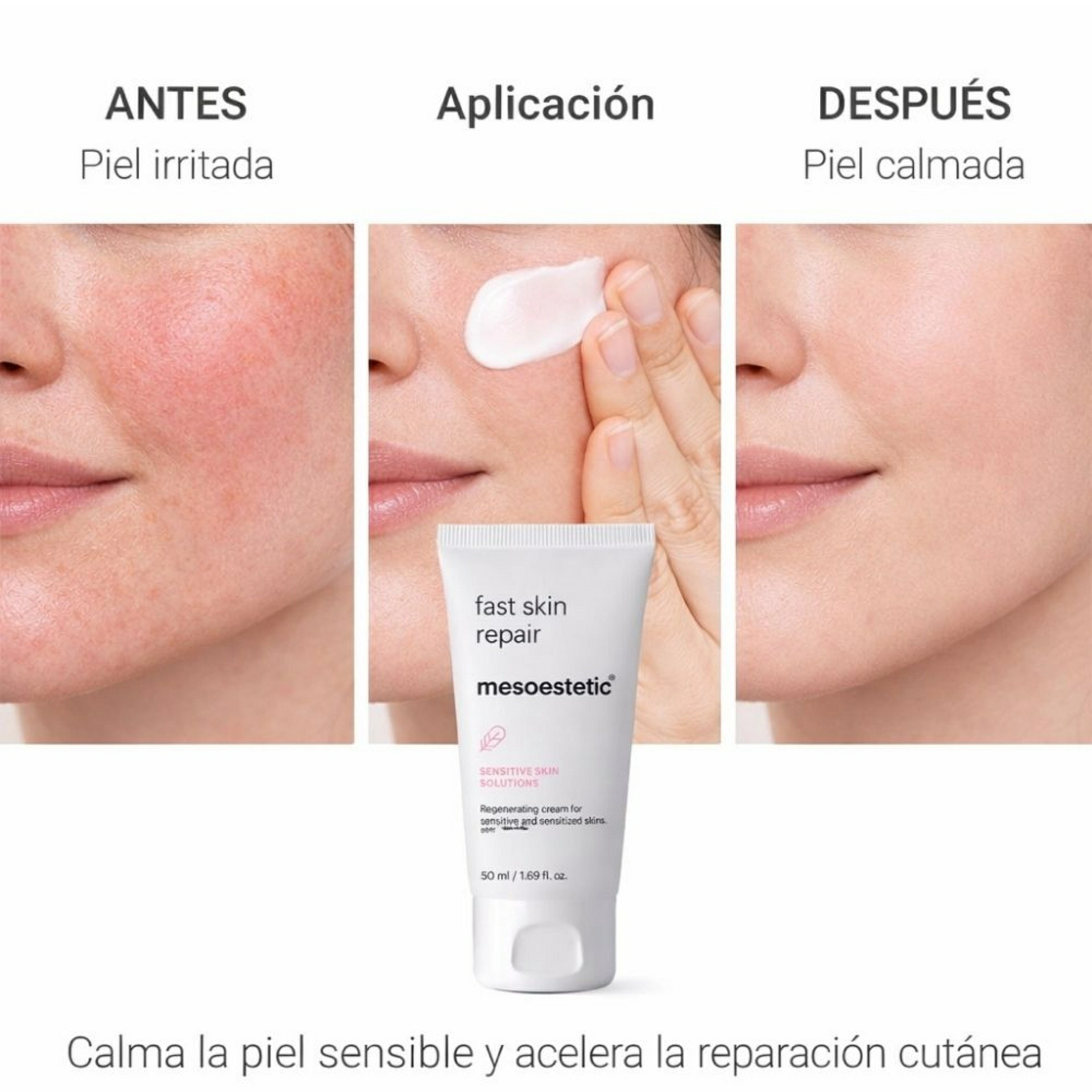 Fast Skin Repair Post-Procedure | Crema 50ml - Sensitive Skin Solutions - Mesoestetic ®