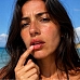 Labios quemados por el sol: cómo curarlos, tratarlos y prevenirlos