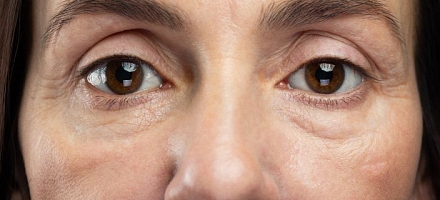 Los mejores contornos de ojos para bolsas