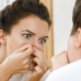 Puntos negros en la cara: causas, tratamiento y cómo eliminarlos eficazmente