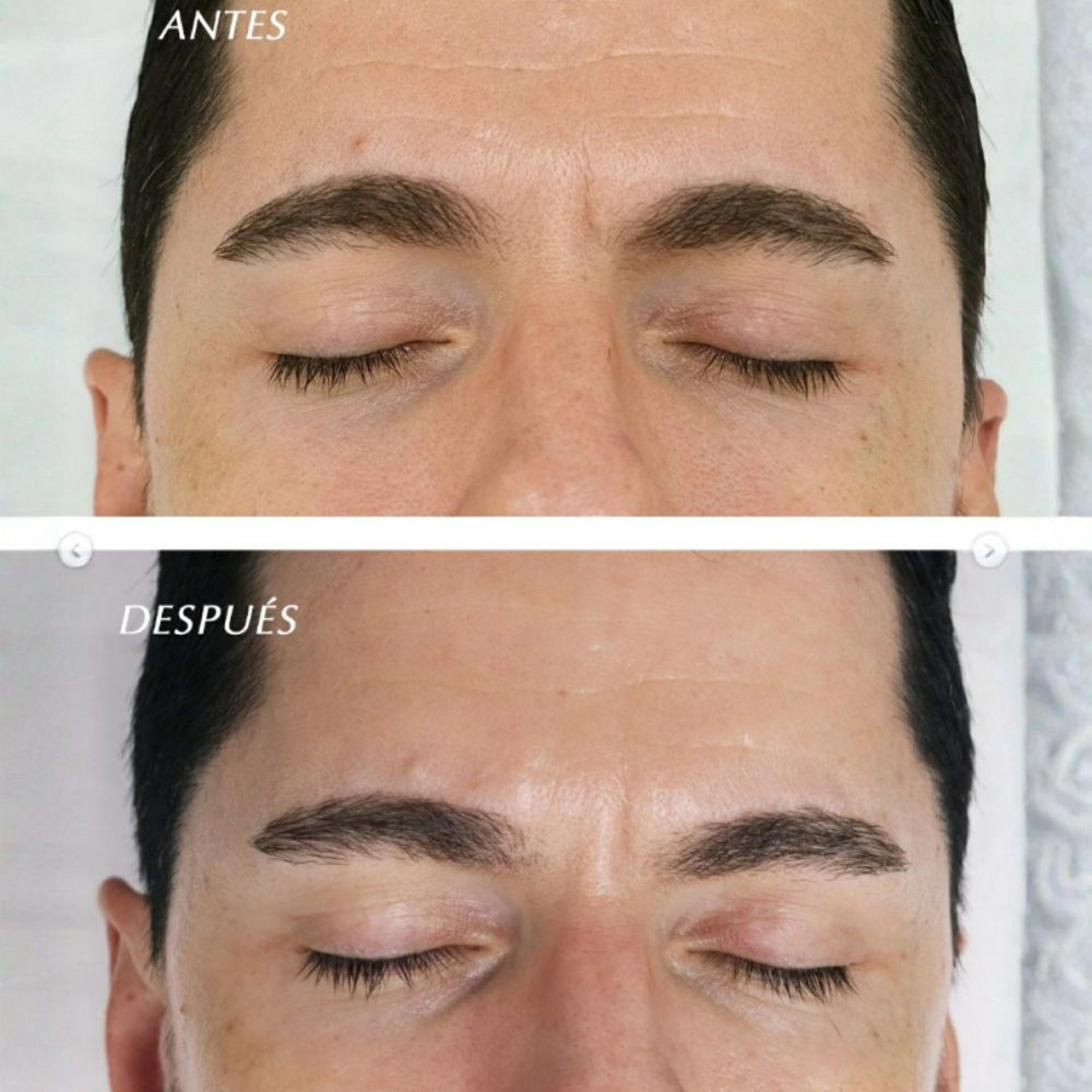 Renewal Night Cream - 0,15% y 0,3% | Crema de noche con retinol 30 ml- Retinol PROAGE - Casmara ®