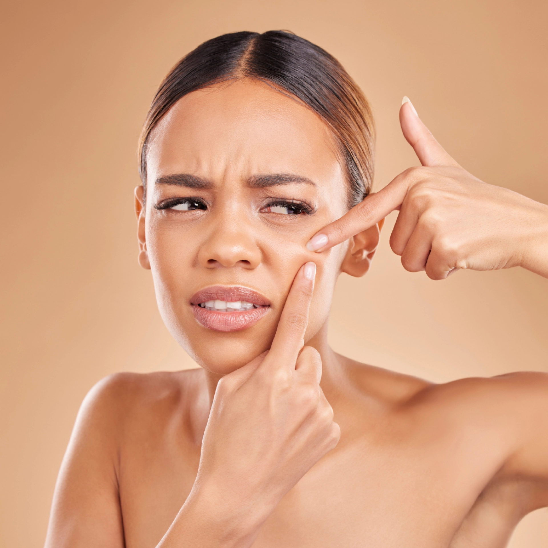 Serum Crème AcniLogic | Serum Piel Grasa 30ml - Guinot ®