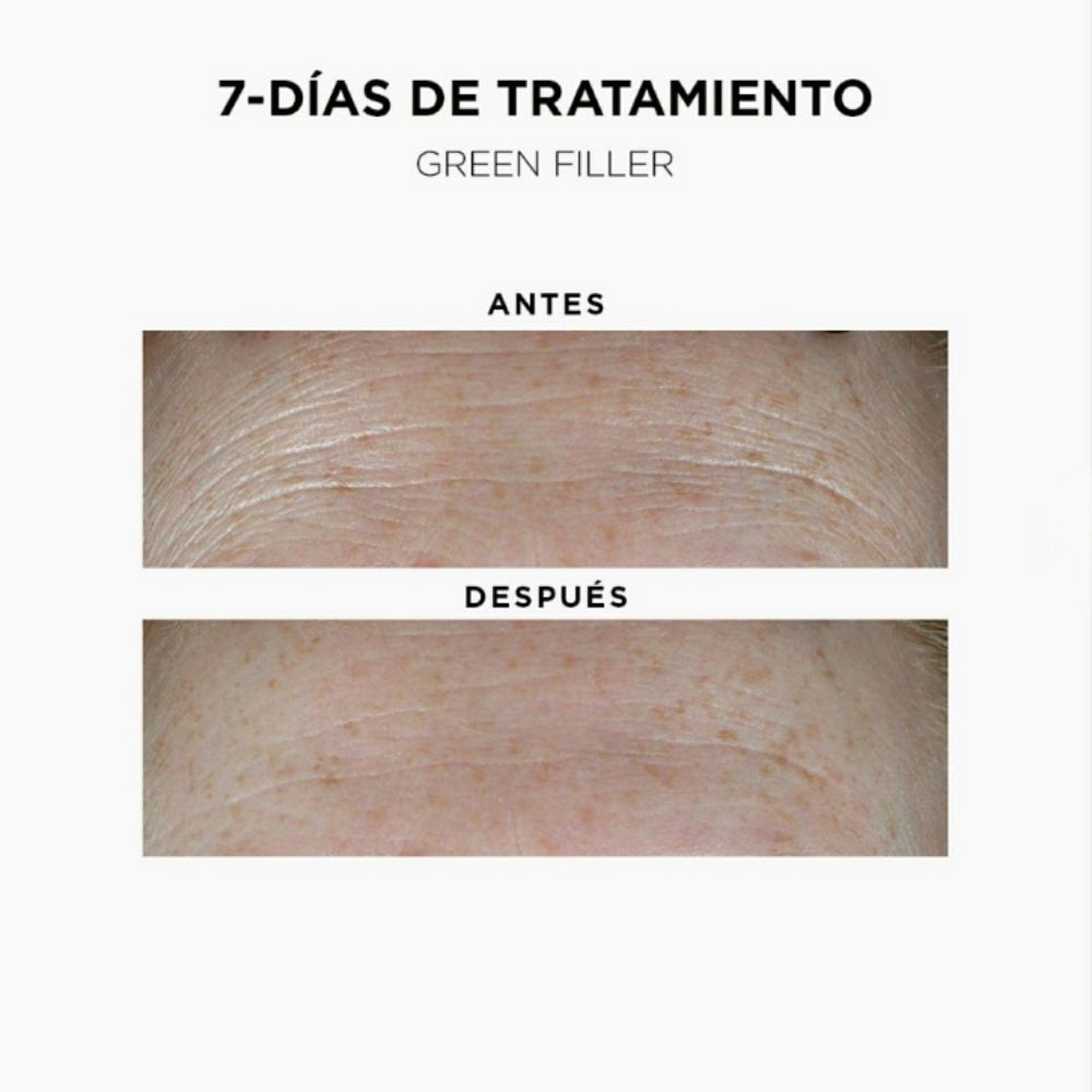 Soin Cure 7 Jours | Ampollas Rellenadoras de Arrugas 7 x 1,2 ml - Green Filler - Ella Baché ®