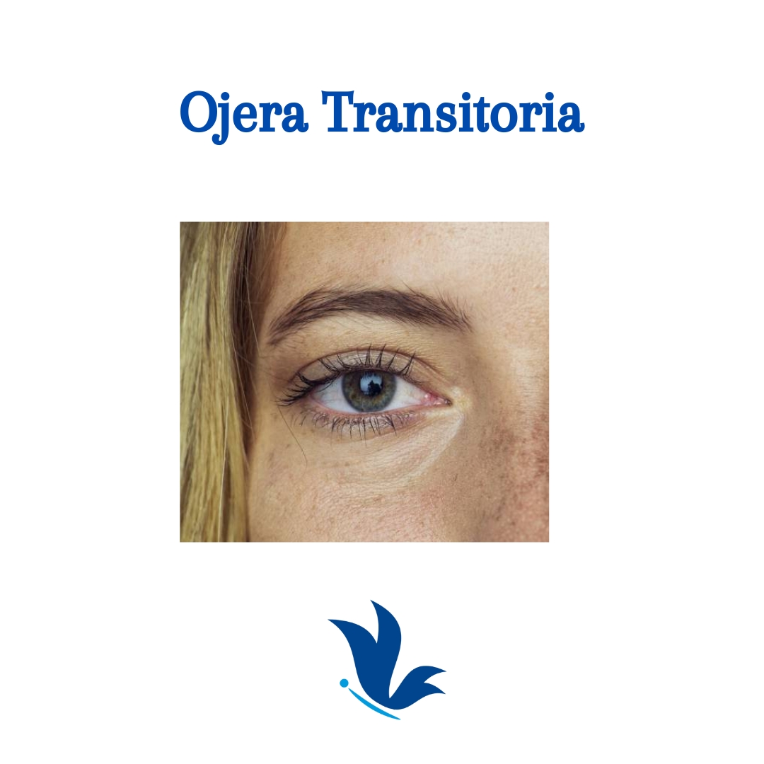 Ojera Transitoria 