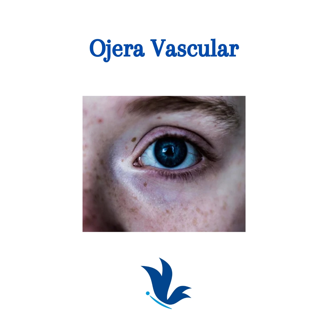 Ojera Vascular