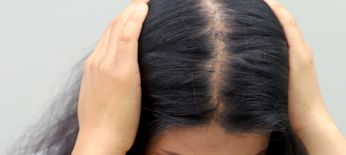 TR10 Capilar Solution opiniones