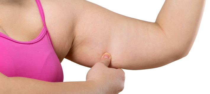 Causas de flacidez en los brazos